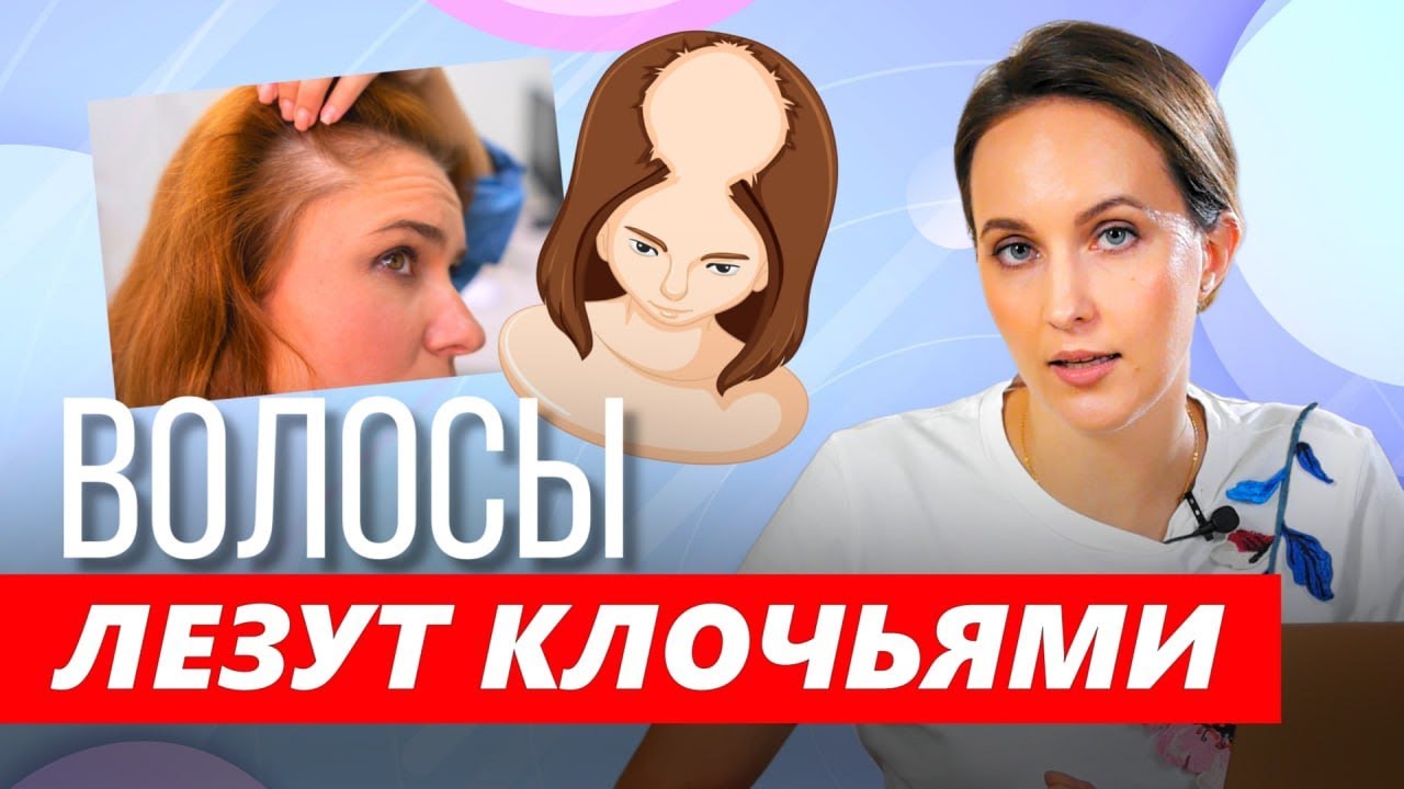 Как остановить выпадение волос: ищем причину. Доктор Ирина Шевченко