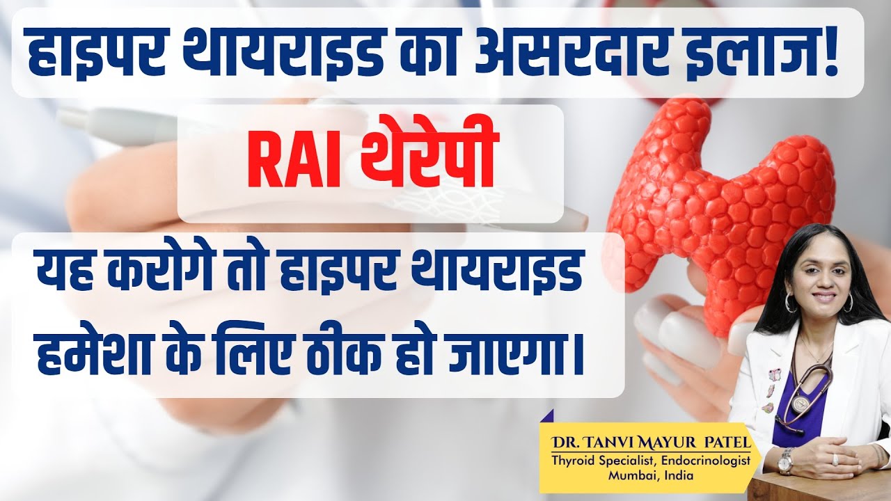 हाइपरथायराइडका असरदार इलाज RAI रेडियोएक्टिव आयोडीन थेरेपी Dr Tanvi Mayur Patel
