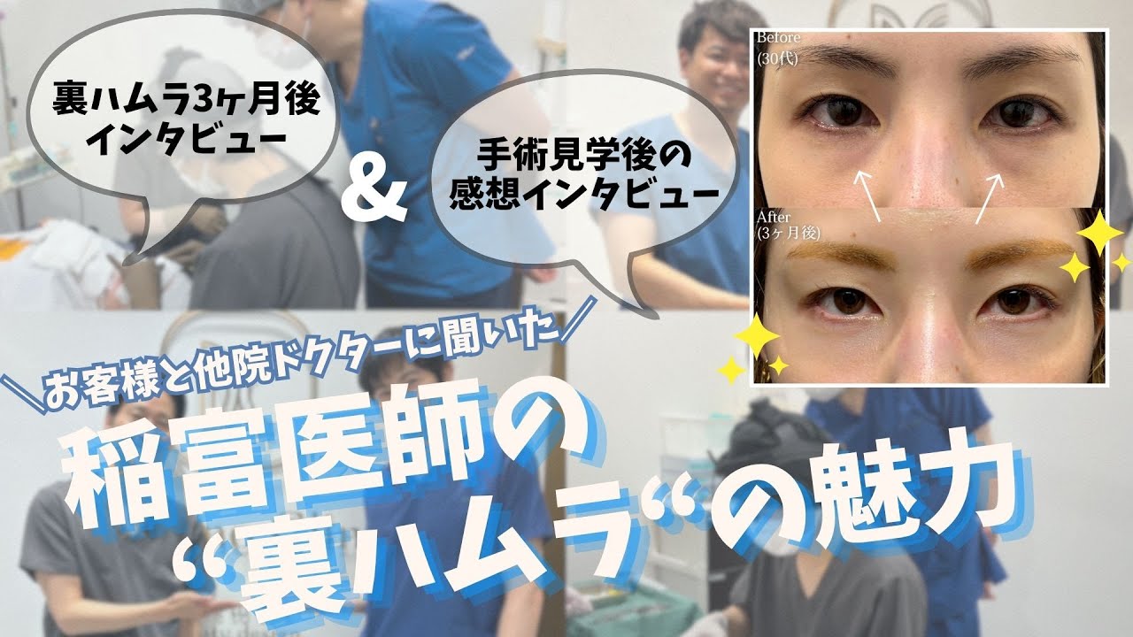 形成外科専門医/稲富医師のクマ取りの
