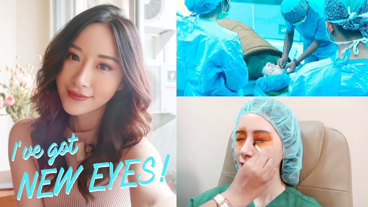 My LASIK - ReLEx SMILE Experience (is it worth it?) | Eng Sub