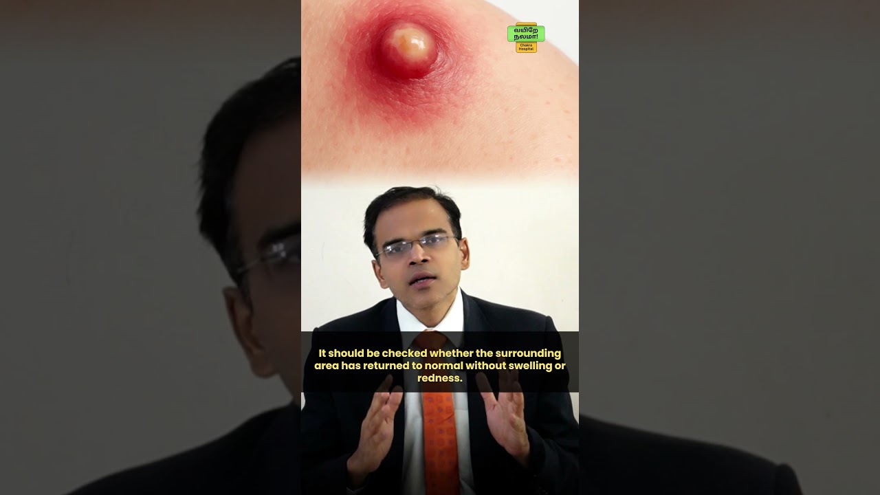 💡 How to know if your fistula is healing &mdash; key signs explained! #FistulaRecovery #FistulaTreatment