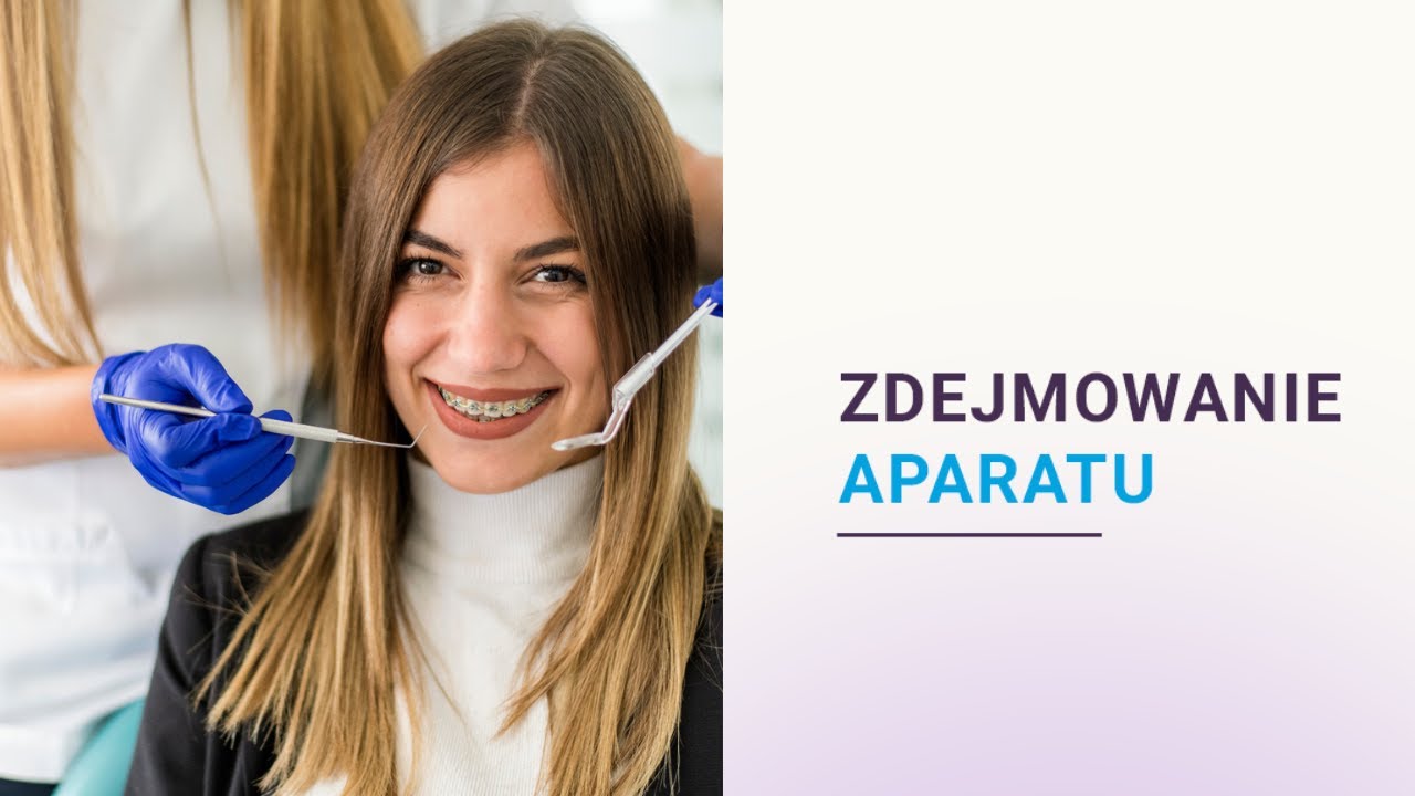 Zdejmowanie aparatu ortodontycznego | Ortodent Rzeszów