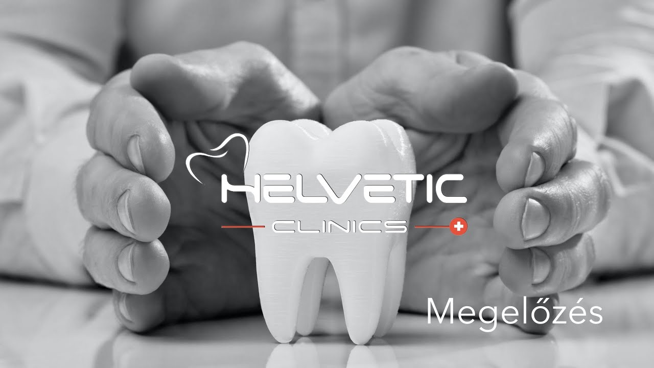 Helvetic Clinics - Megelőzés a fogászatban