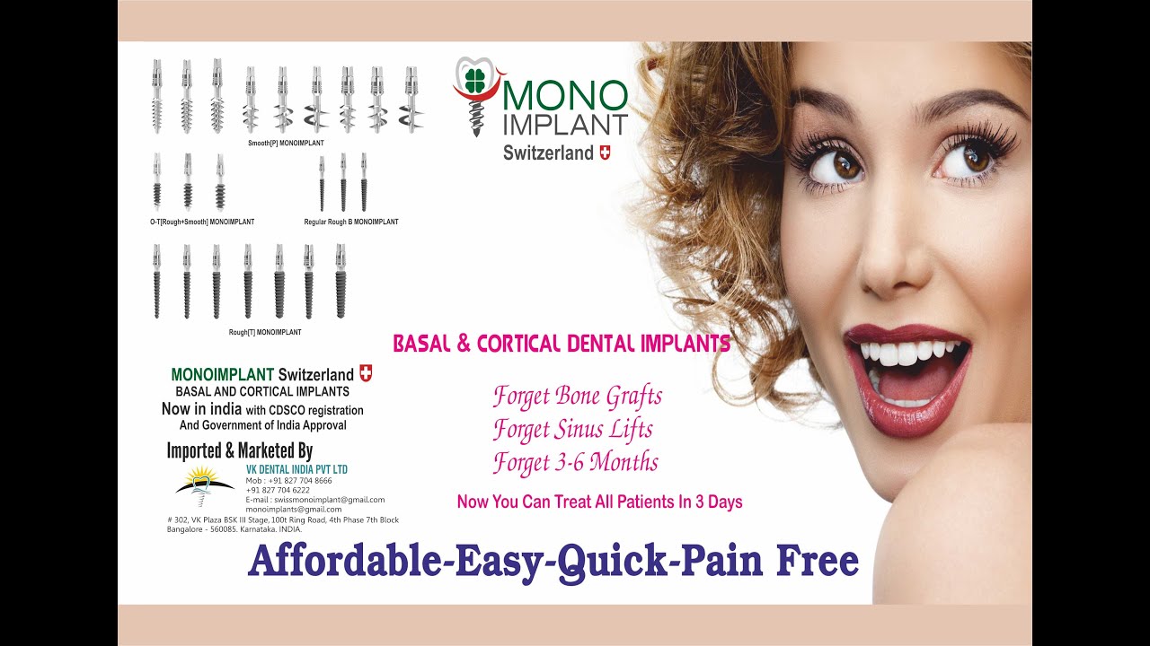 Monoimplants -  Cortical implantology