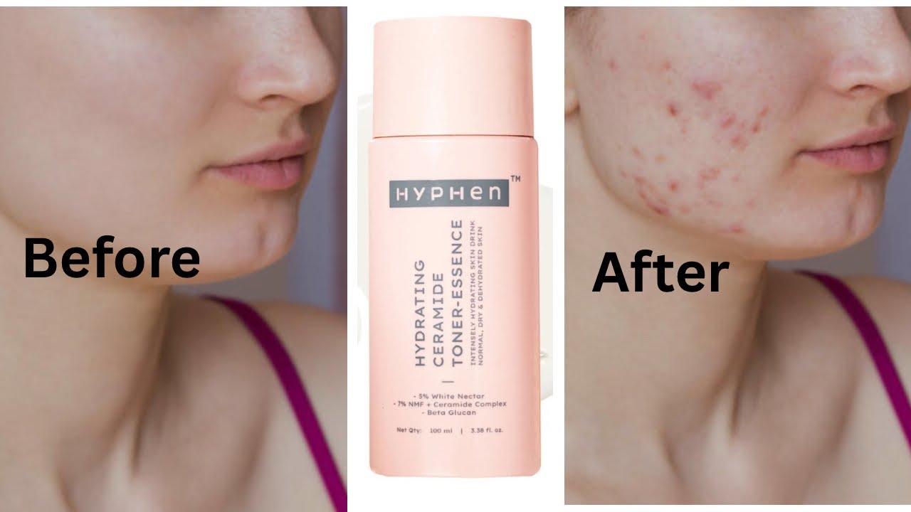 Hyphen milky toner review || Hyphen hydrating ceramide toner || save your money 💰 