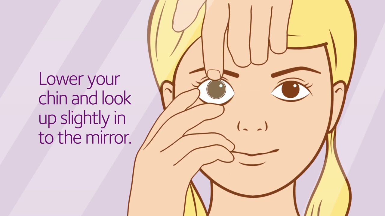 How to remove your MiSight® 1 day contact lenses