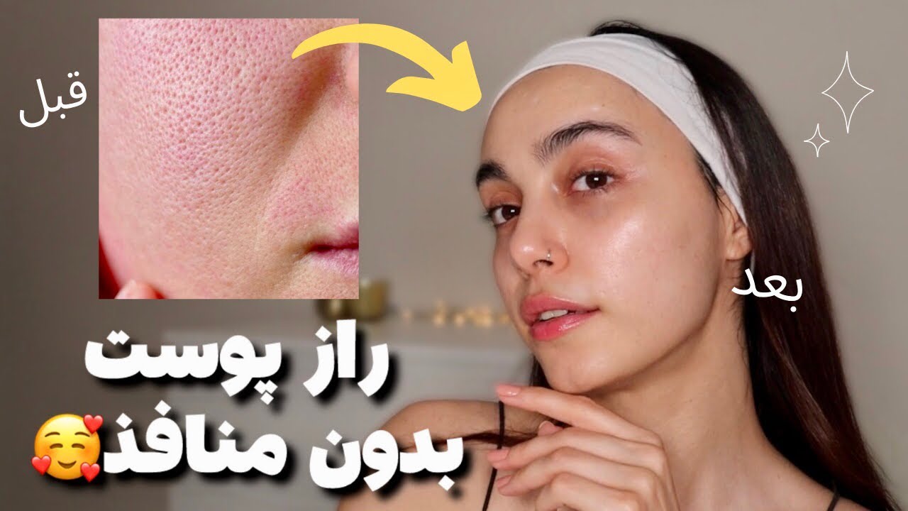 با منافذ باز پوستم خداحافظی کردم | روتین پوستی و نکاتی که کسی نمیگه‼️