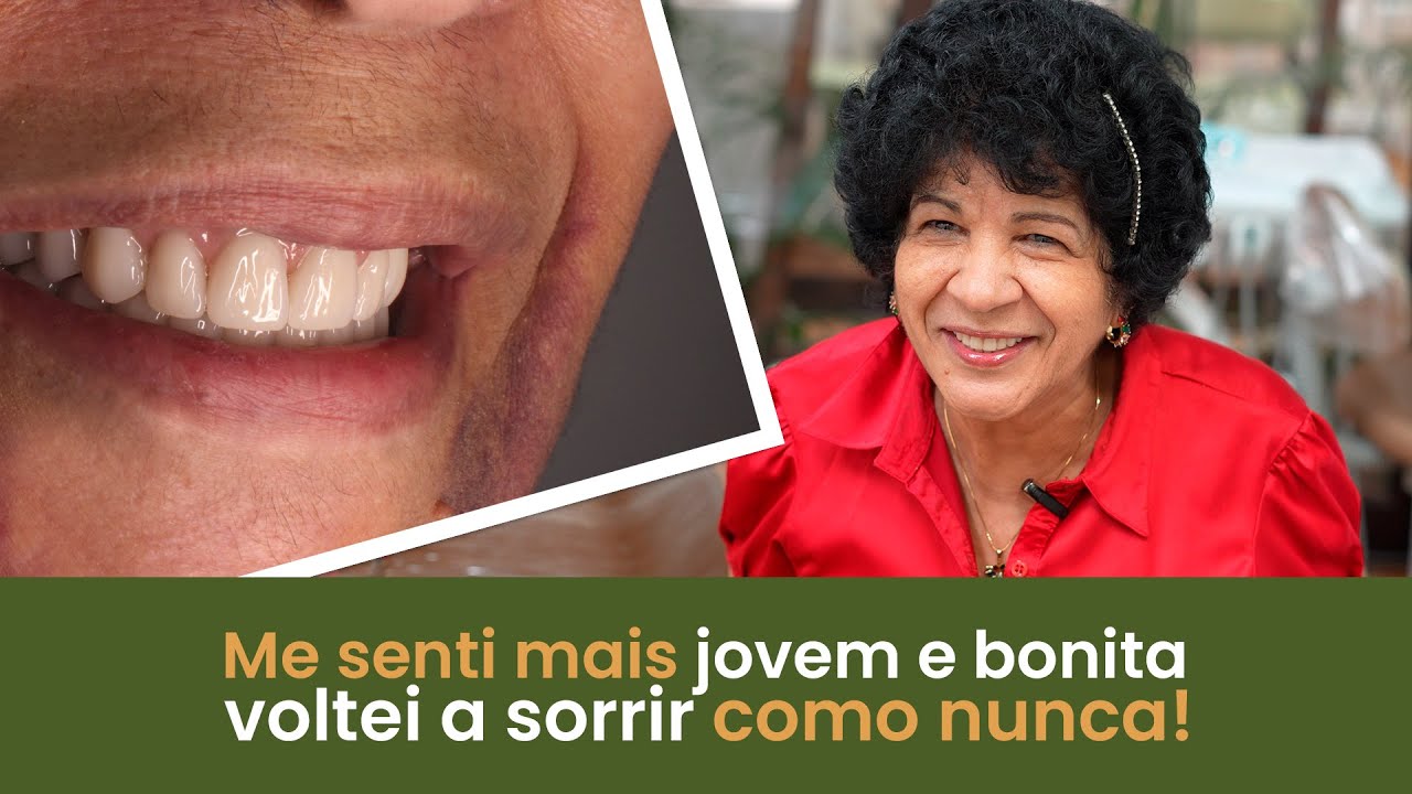 Me Senti Mais Jovem e Bonita, Voltei a Sorrir Como Nunca! - Implace Implantes