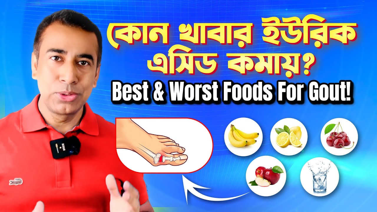 গেঁটে বাত/ গাউট থেকে মুক্তির উপায় ৷ যে ৯টি খাবার রক্তে ইউরিক এসিড কমায় ৷ বাতের ব্যথায় করণীয় ৷ Gout