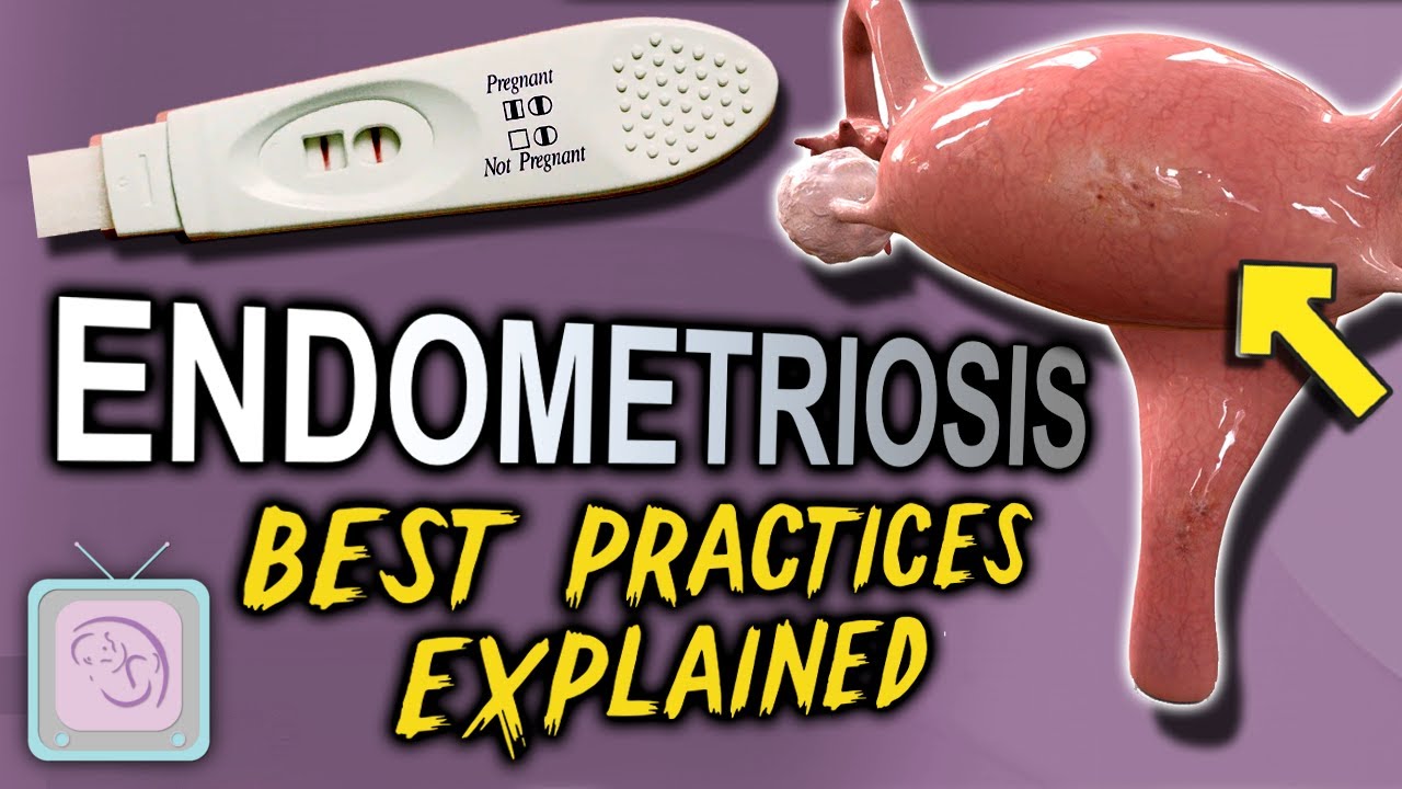 Endometriosis & Fertility - The most important issue your doctor never told you about