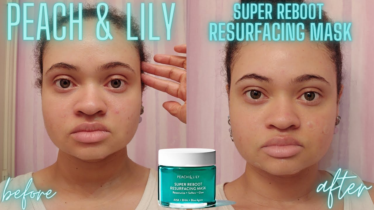 Acne Go Away Series: Peach and Lily Super Reboot Resurfacing Mask Review