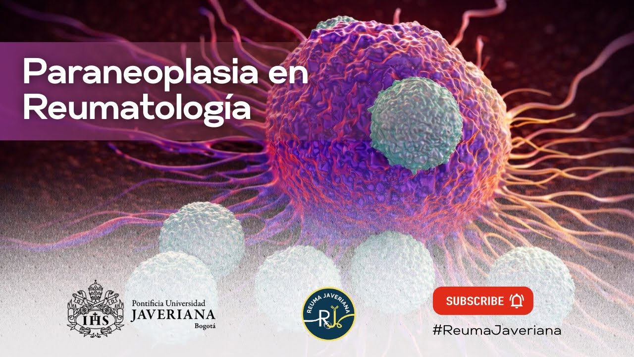 Paraneoplasia en reumatología