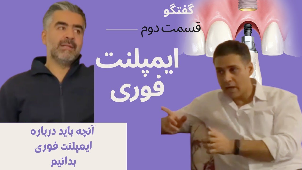 ایمپلنت فوری -2 |  نیاز به انجام درمان ایمپلنت دارید ولی نمی خواید بی دندون بمونید اینو حتما ببینید