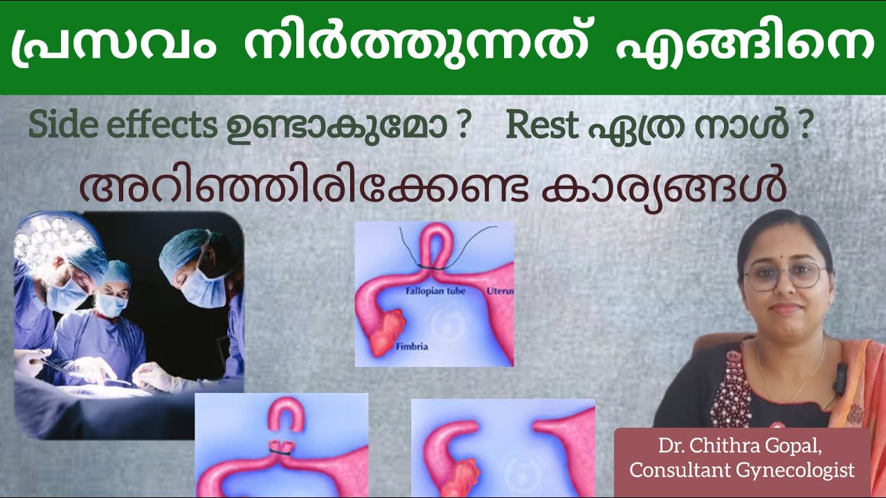 Female sterilization explained in Malayalam / പ്രസവം നിർത്തുന്നത് എങ്ങിനെ 