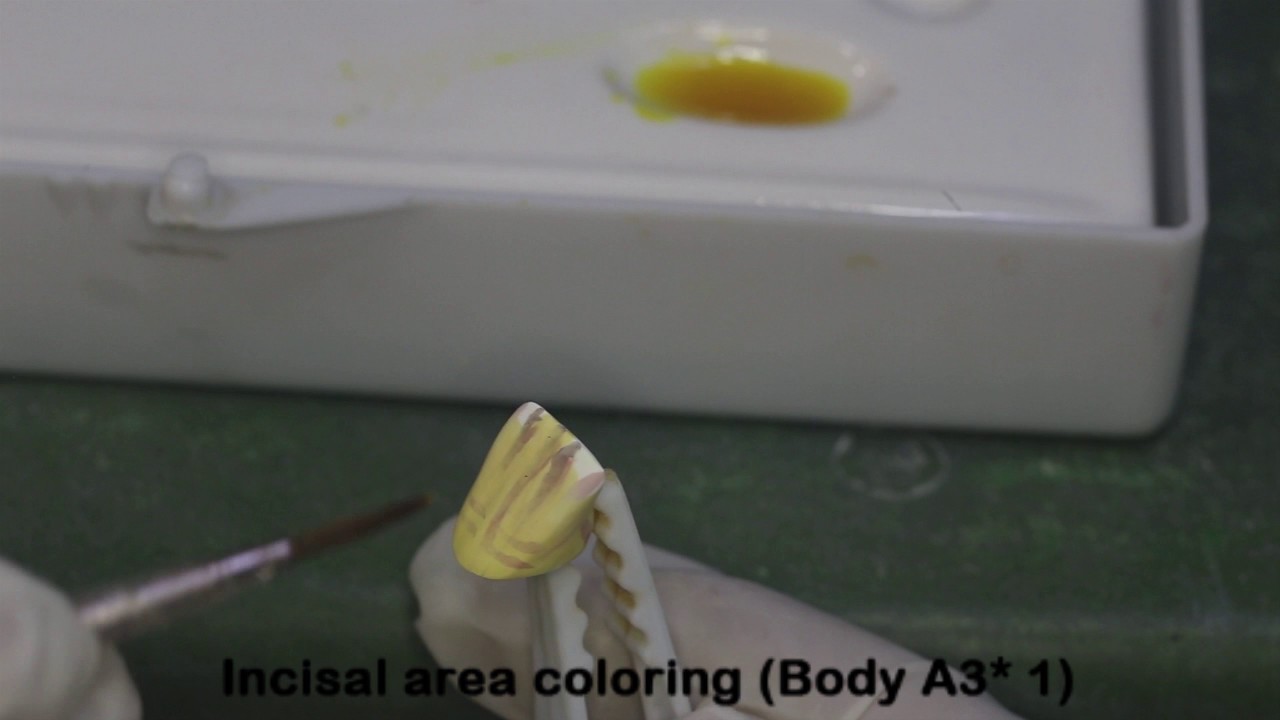 Done By Amin Hasoneh_ SDL Pre-Sinterd Zirconia Coloring Advanced Technique for interior single crown