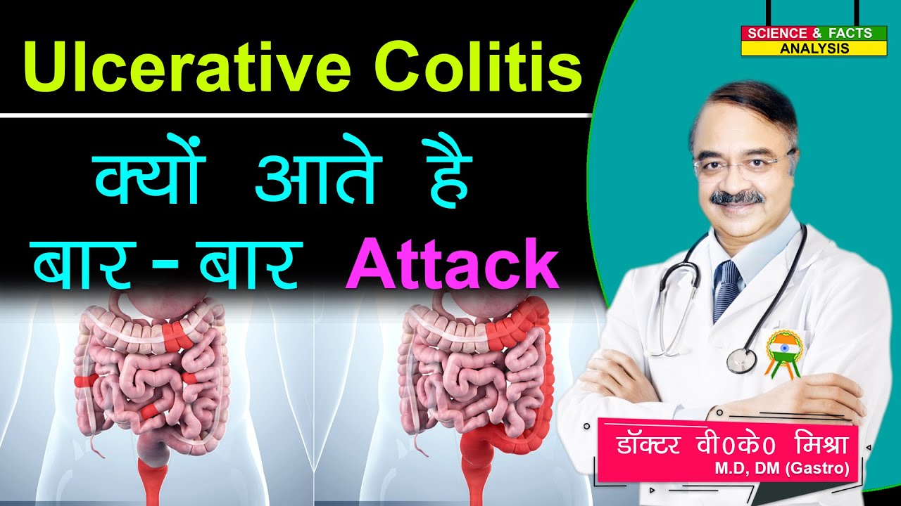 Ulcerative Colitis क्यों आते है बार बार attack || 6 WAYS TO PREVENT A ULCERATIVE COLITIS FLARE UP