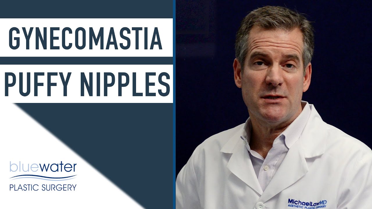 Are Puffy Nipples a Form of Gynecomastia? | Gynecomastia Surgery Raleigh