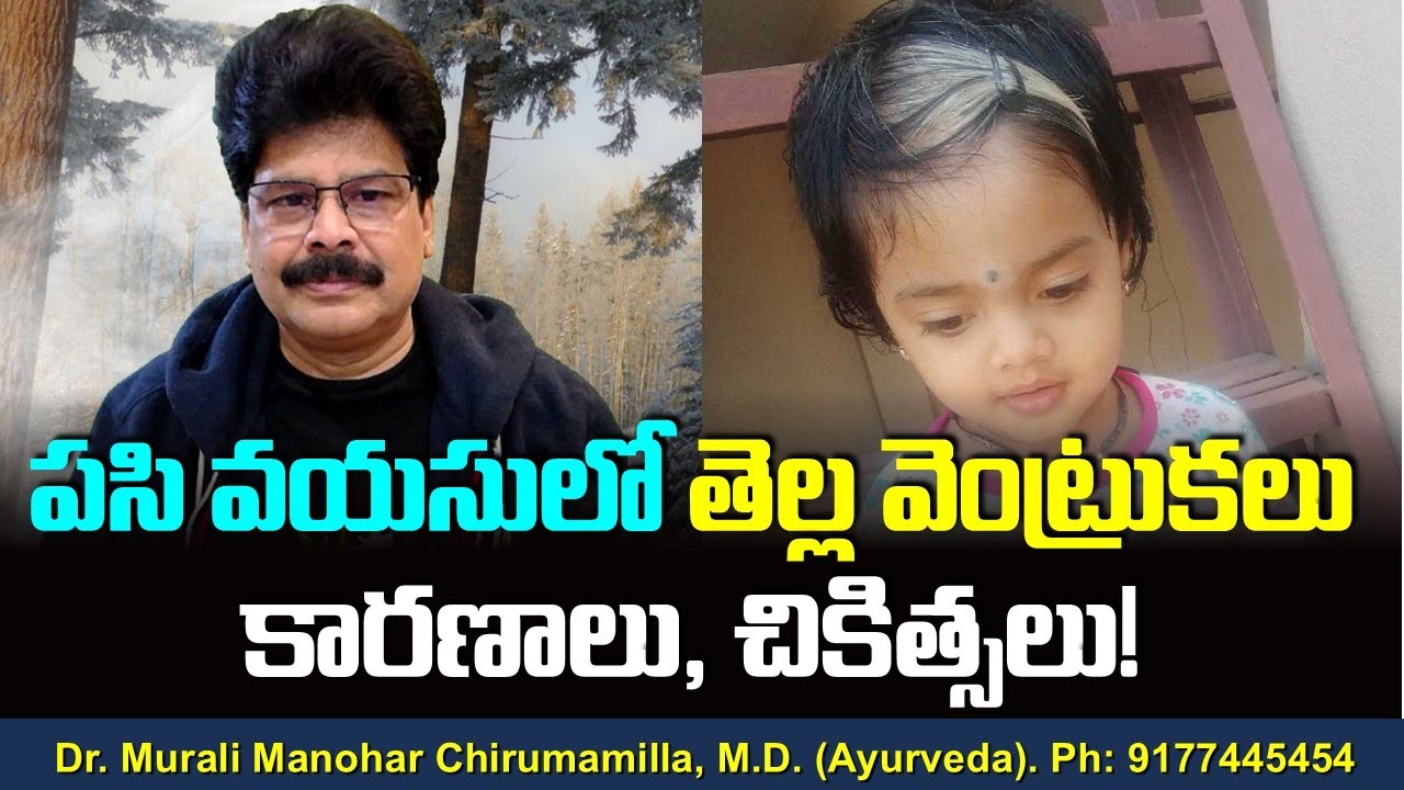 పసి వయసులో తెల్ల వెంట్రుకలు - కారణాలు, చికిత్సలు! How to Turn White Hair to Black Hair.