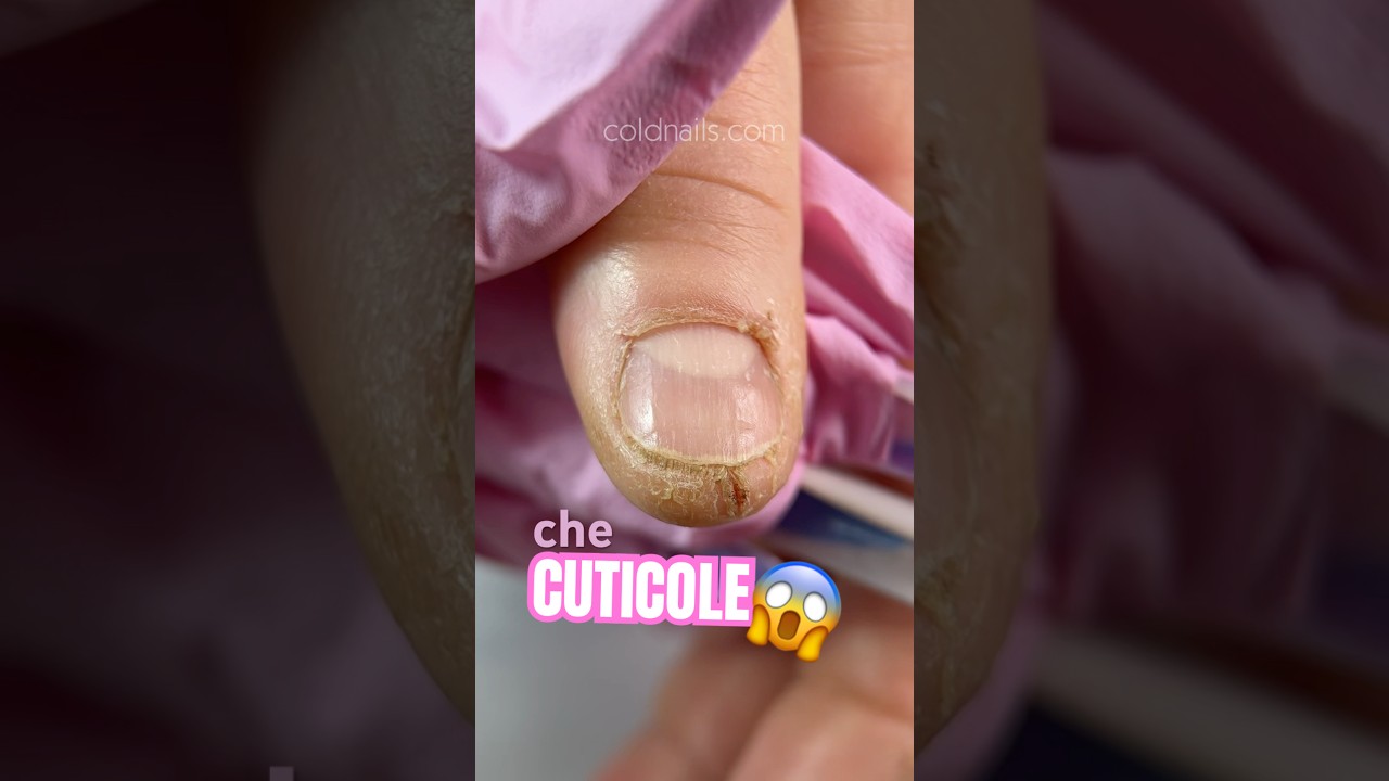 Cuticole disastrate 😱 facciamo il miracolo!? prodotti usati Cold Nails ❤️ #unghie #nails #nailart