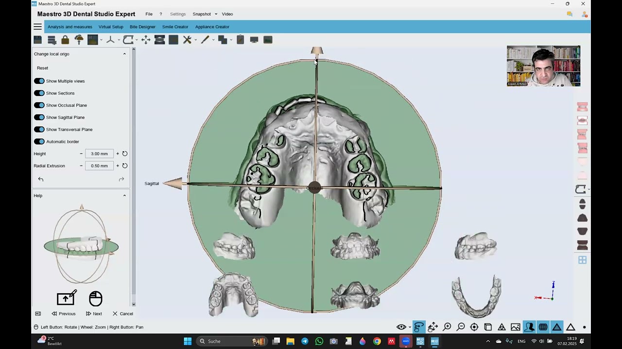 HOW TO PREPARE THE ALIGNER CASE  IN MAESTRO 3D