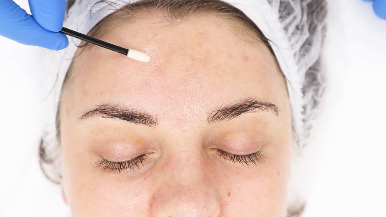 Peeling chemiczny - Ogólnopolska Akademia Kosmetologii