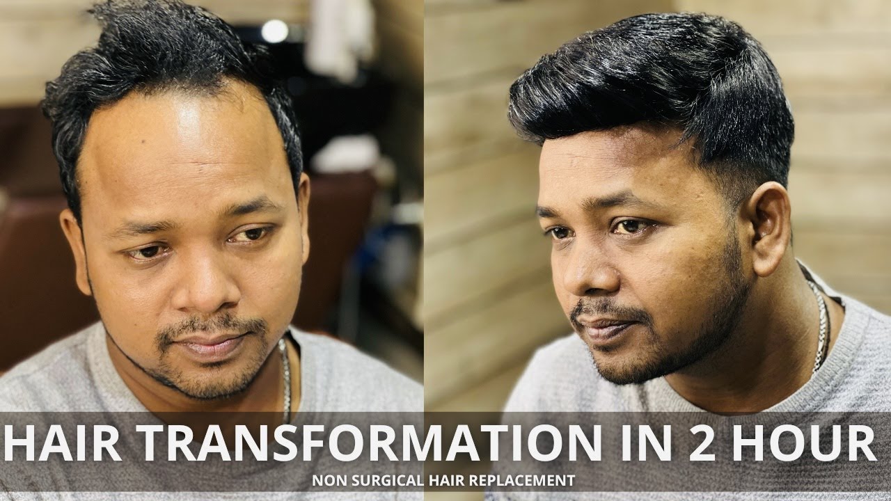 Hair Transformation | Non surgical Hair Replacement in 2 hour | Hair patch & wig for men in india