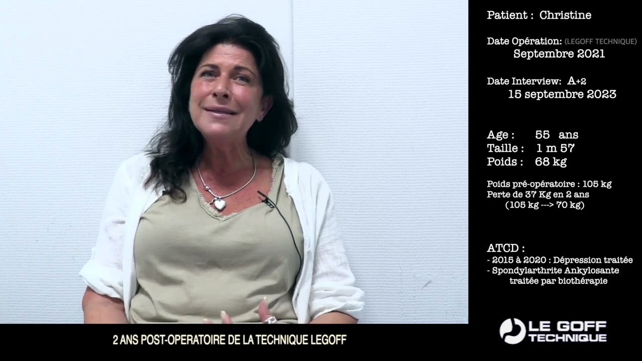 Interview Christine 8 - Choix entre la Technique Legoff et l'Anneau gastrique classique