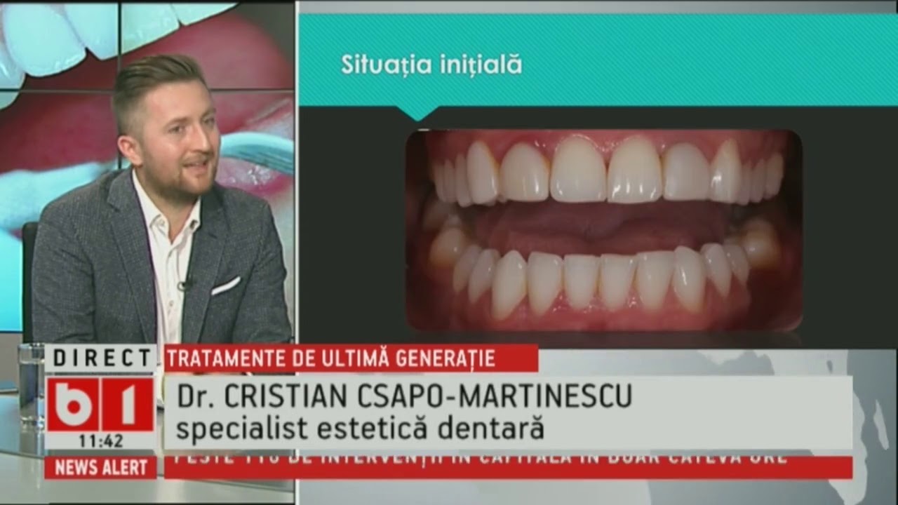 TALK B1 CU IRINA PETRARU: TRATAMENTE DENTARE DE ULTIMA GENERATIE. DINTI DE VEDETA. 26 IAN 2019