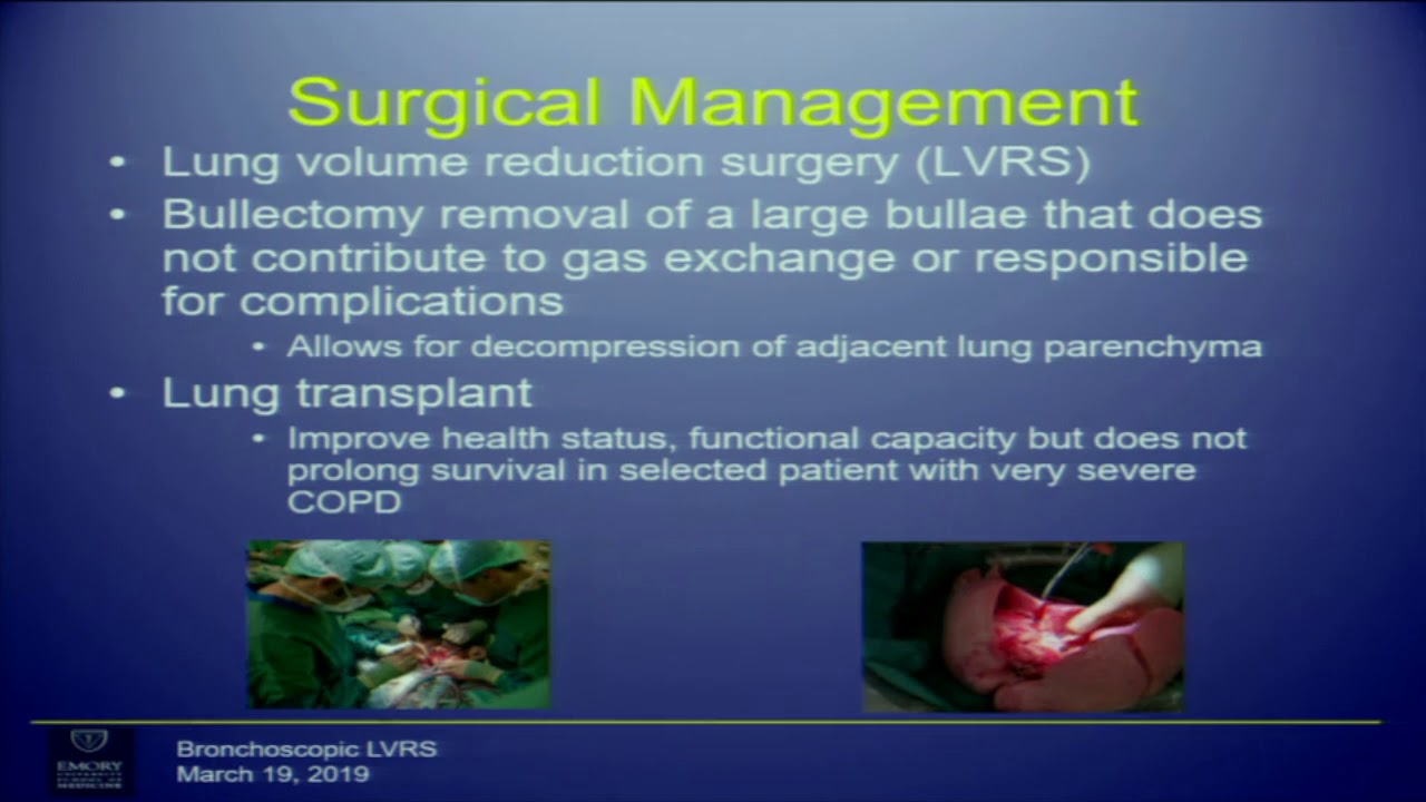 Medicine Grand Rounds: Endoscopic lung volume reduction for COPD 3/19/19