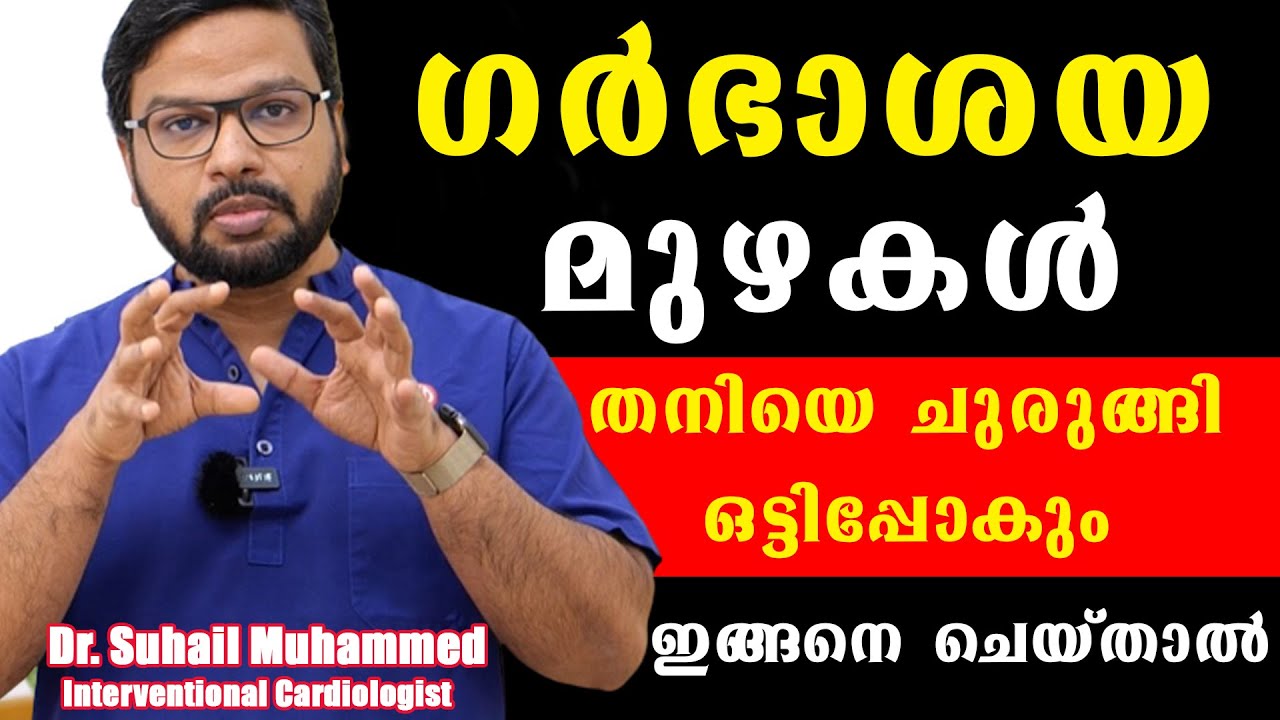 ഗർഭാശയ മുഴകൾ തനിയെ ചുരുങ്ങി ഒട്ടിപ്പോകും ഇങ്ങനെ ചെയ്താൽ /Dr Suhail Muhammed P.T /Baiju's Vlogs