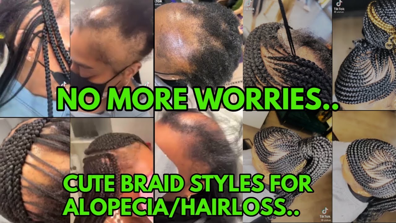 CUTE BRAID STYLES FOR WOMEN WITH ALOPECIA, HAIRLOSS, THIN & DAMAGED HAIR