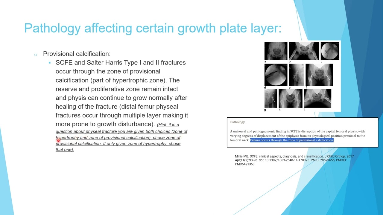 Growth in Pediatric Orthopedics