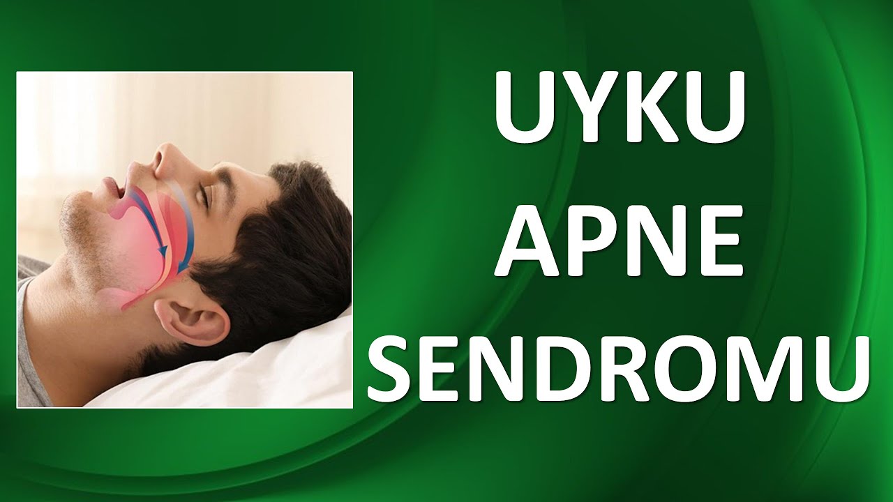 UYKU APNE SENDROMU NEDİR? NASIL TEDAVİ EDİLİR?