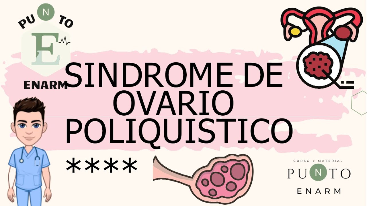 SINDROME DE OVARIO POLIQUISTICO. ENARM