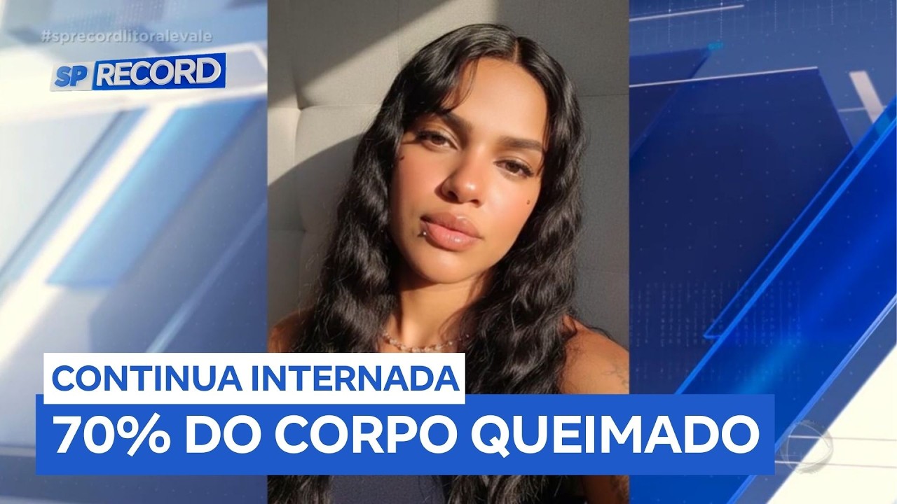 Jovem que teve 70% do corpo queimado em bufê continua internada