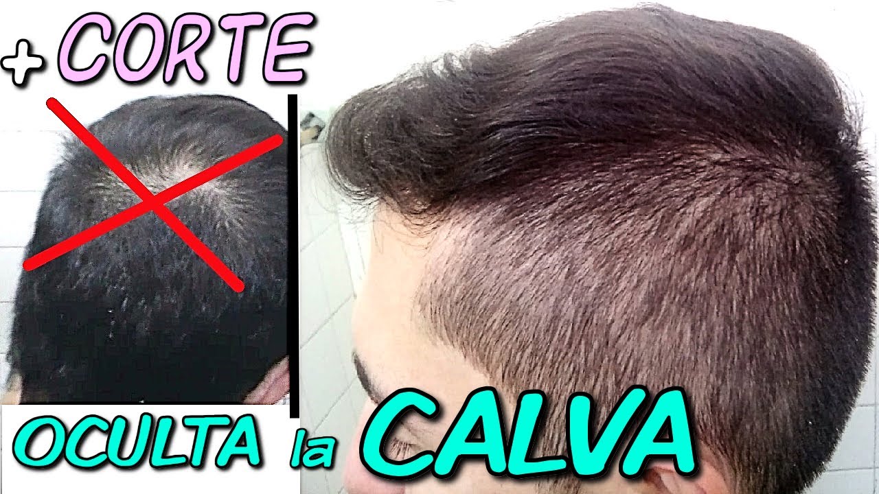 Como Disimular Calvicie o Esconder CALVICIE | C&oacute;mo Ocultar las Entradas y Ca&iacute;da de Cabello