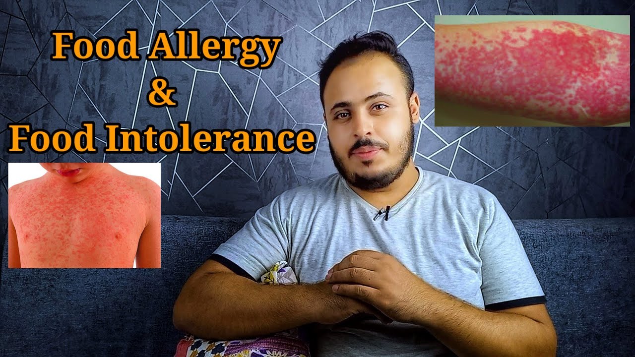 الفرق بين Food allergy و Food intolerance