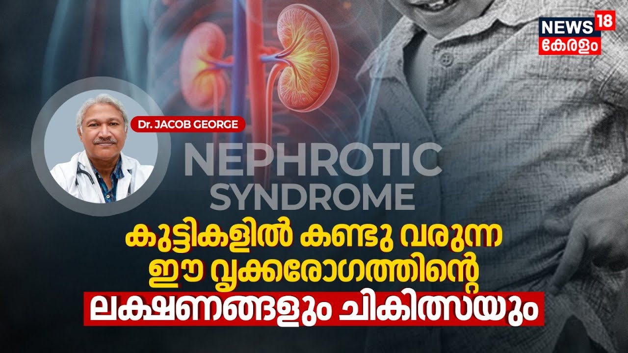 Dr. Q | Nephrotic Syndrome | കുട്ടികളിൽ കണ്ടു വരുന്ന ഈ kidney disease's Symptoms & Treatment | N18V