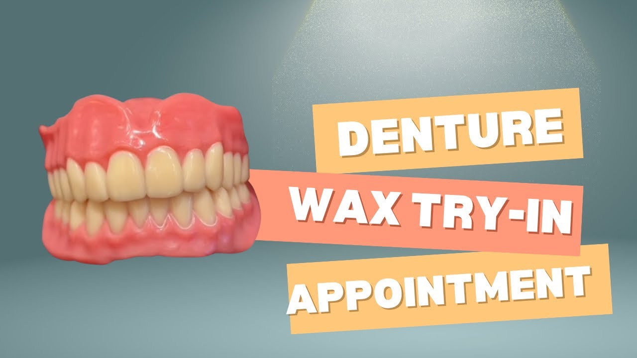 Denture Wax Try-In Checklist