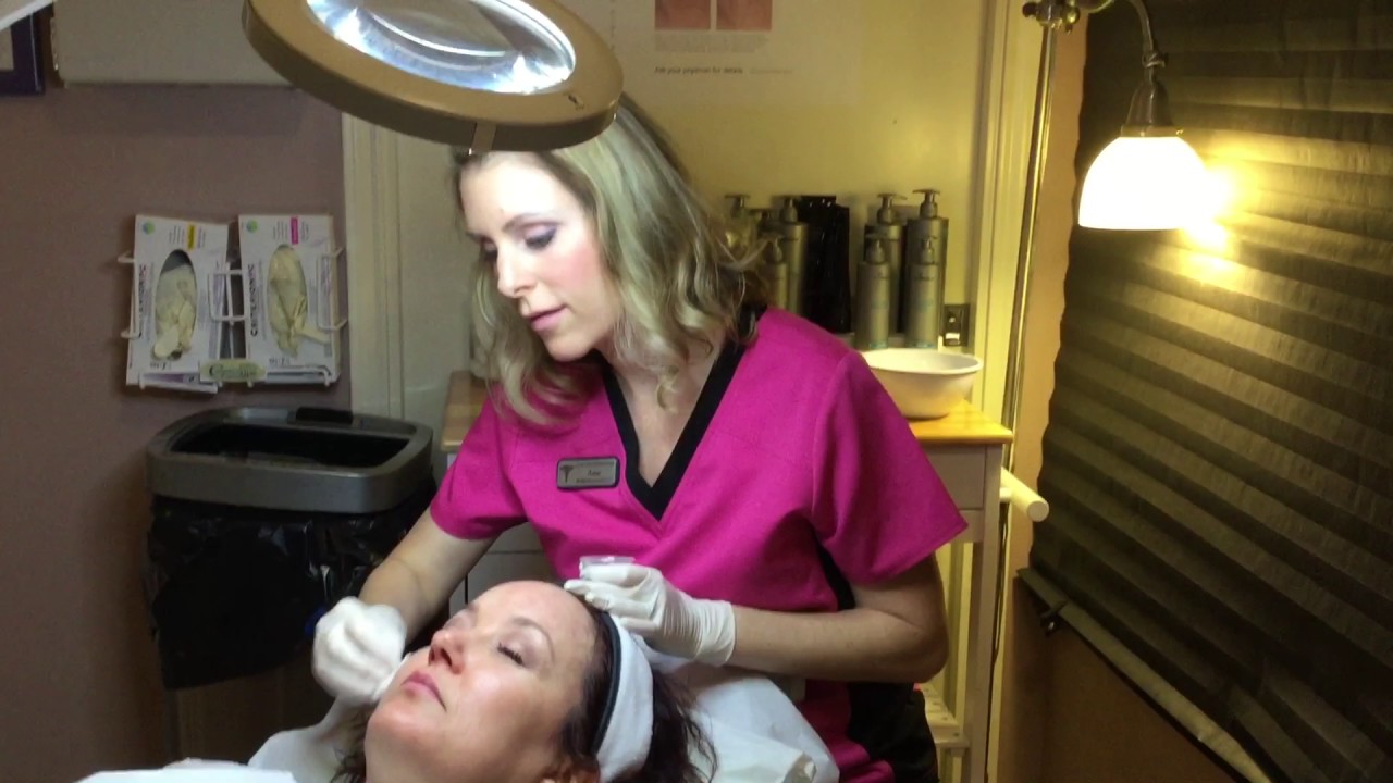 Vitalize chemical peel