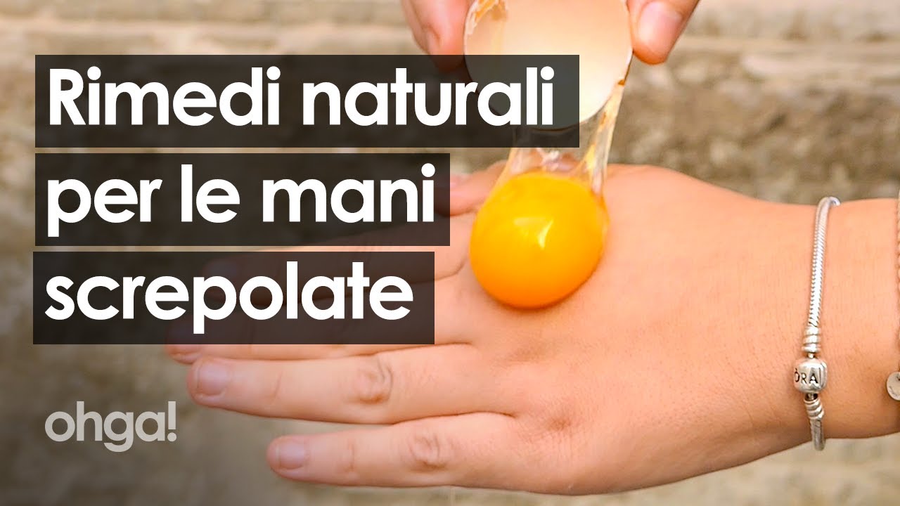 Hai le mani screpolate? Perché non provi uno di questi sei rimedi naturali!