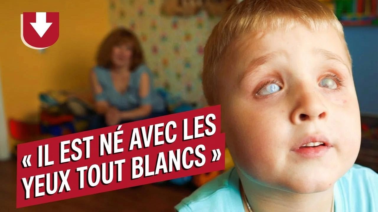 Mon fils est né aveugle : le témoignage d’Olga | Vivre la maternité