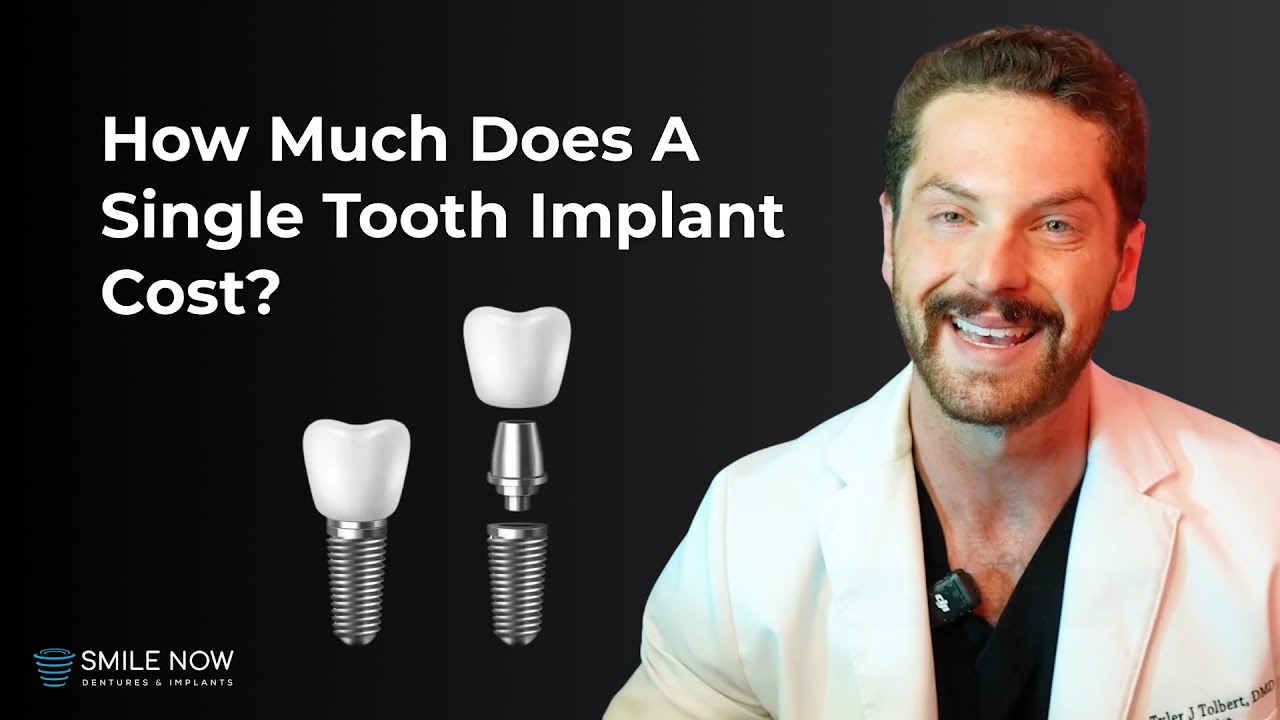 Single Tooth Implant Cost Without Insurance: What to Expect at Smile Now