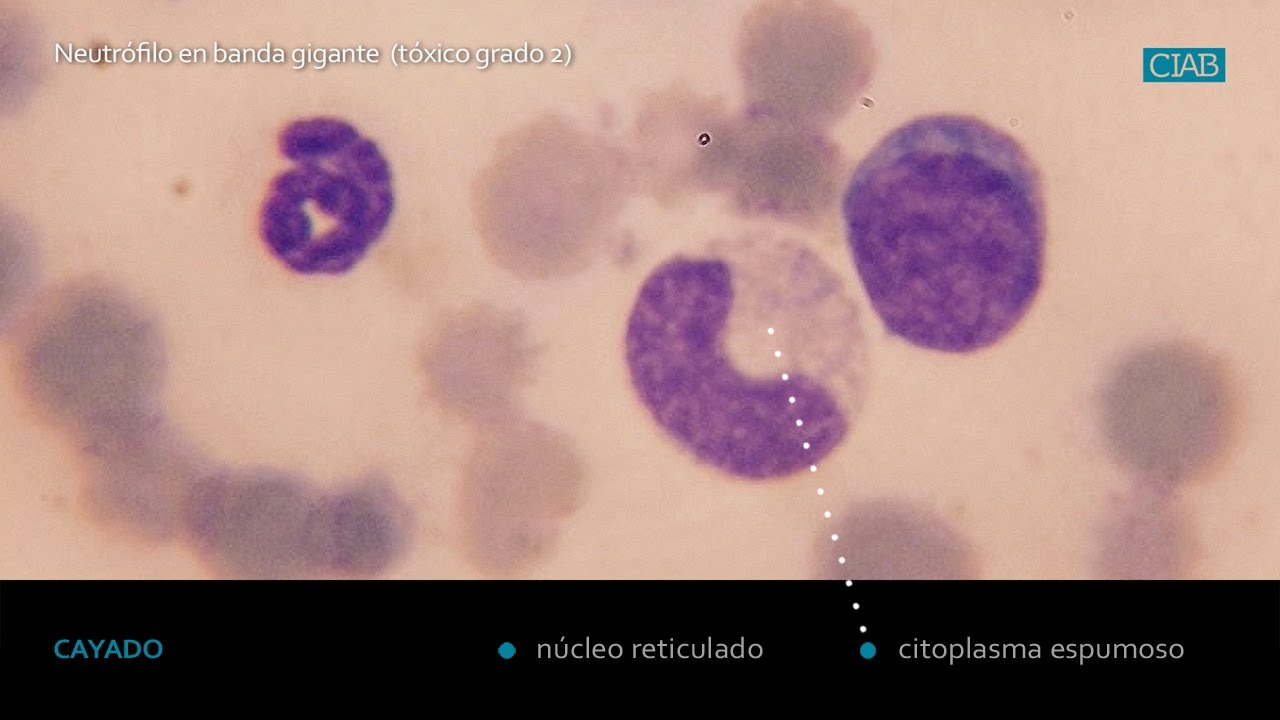 Neutrofilo en banda gigante. www.ciab.es.
