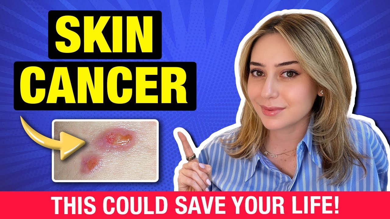 Skin Cancer: How to Protect Yourself—ABCDEs & Sun Protection Hacks! | Dr. Shereene Idriss