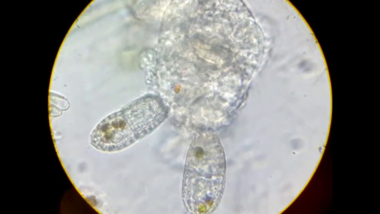 Инфузории Coleps едят мертвую коловратку /// Ciliate Coleps eat dead rotifers
