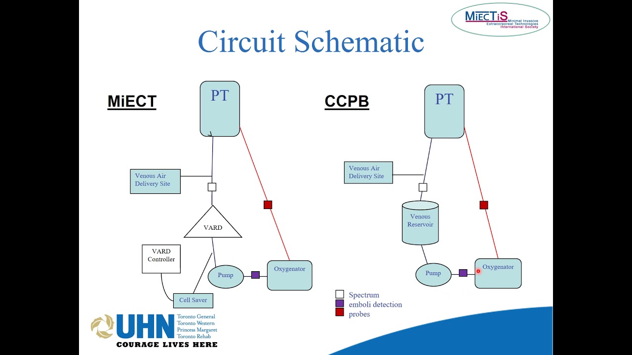 Serrick C. | MiECT: Concentrating on Safe Perfusion
