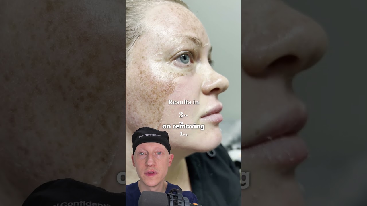 POV: Вы узнали, что ваши веснушки на самом деле &mdash; результат воздействия солнца.