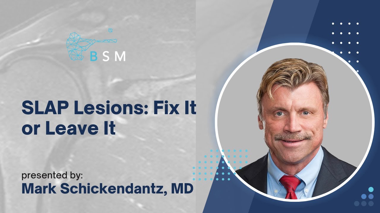 SLAP Lesions: Fix It or Leave It - Mark Schickendantz, MD
