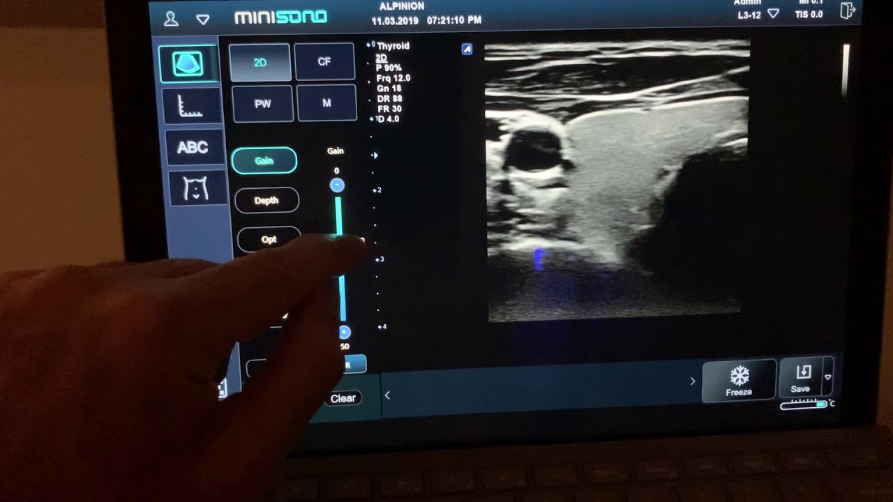 MiniSono tablet ultrasound basic operation